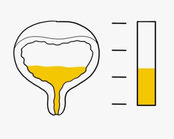 Complément Alimentaire Prostate Renov - Aide à Réduire Le Volume De La Prostate Et Les Brûlures - Fabriqué En France