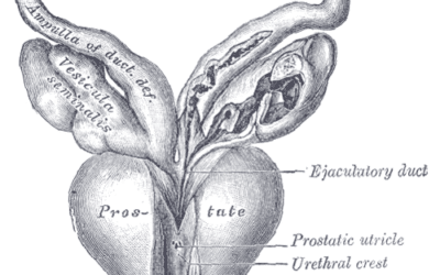 Adénome de la prostate: préserver l’éjaculation c’est possible.