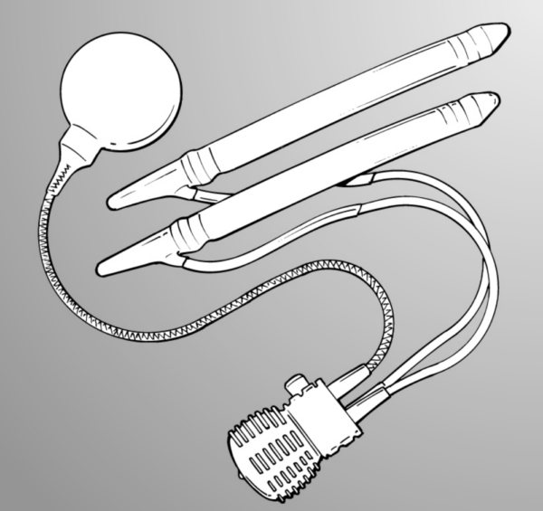 schéma d'un implant médical pour la prostate relié à deux stent pour le traitement de l'hyperplasie bénigne de la prostate