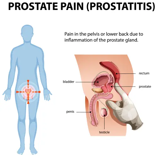 zone ou se situe la prostate chez l'homme