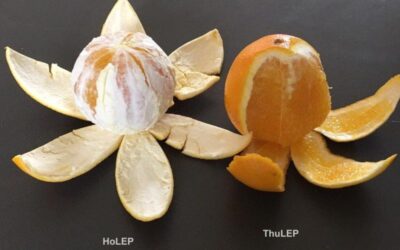 HoLEP (laser Holmium) versus THUFLEP (laser Thulium)— lequel choisir selon la taille de la prostate ?