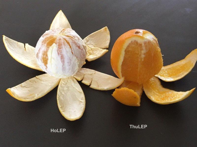 HoLEP (laser Holmium) versus THUFLEP (laser Thulium)— lequel choisir selon la taille de la prostate ?