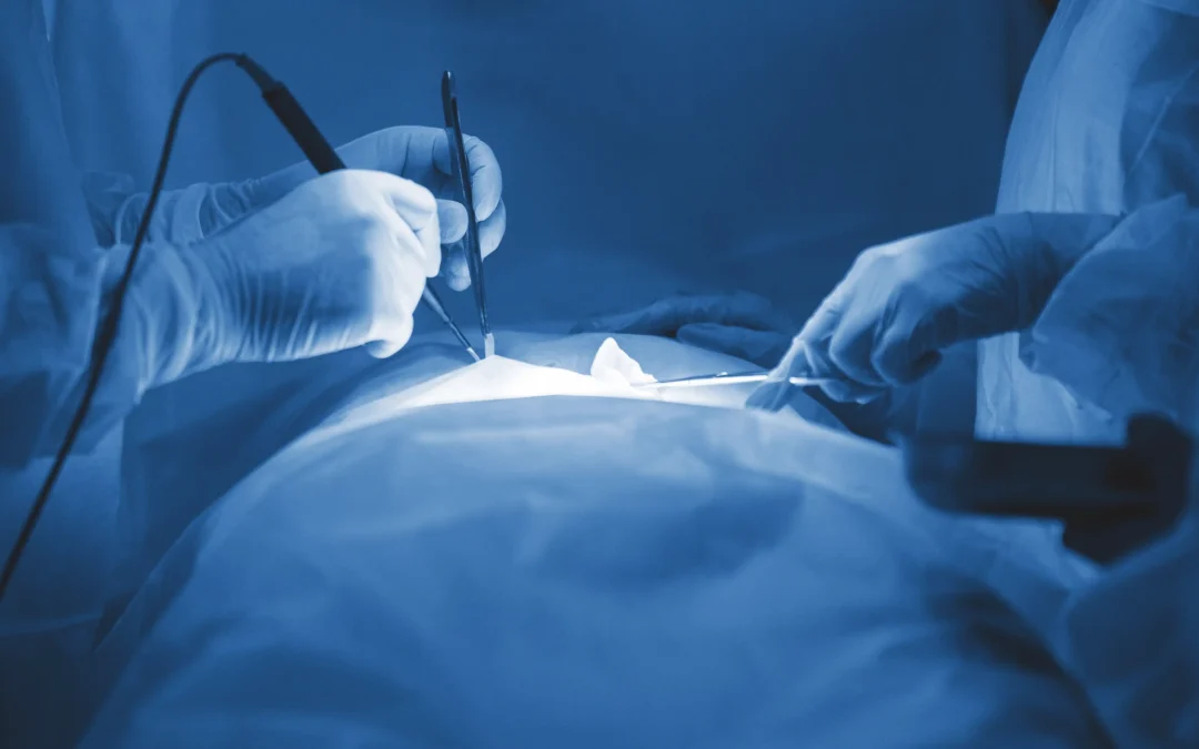 opération pour Comparatif HoLEP (Holmium) et THUFLEP (Thulium) pour l'HBP.