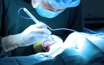 THUFLEP (énucléation au laser Thulium) pour l’HBP : ce qu’il faut retenir